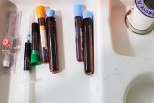 تعطیلی تمام مسابقات و باشگاه های ورزشی تا پایان سال