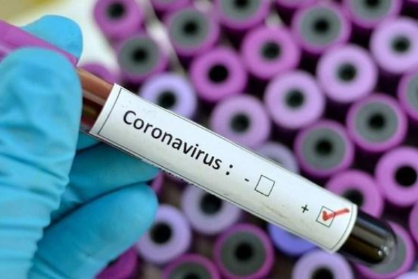 اعلام یک ماه شرایط اضطراری در ژاپن به خاطر کرونا