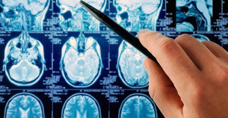 درمان تومورهای بدخیم با سلولهای ایمنی خویشاوند بیمار