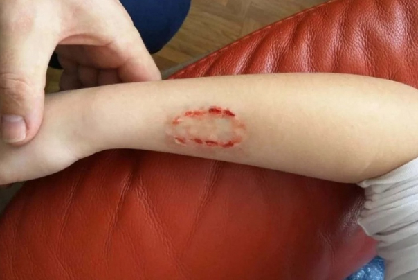 گزارش 370 هزار حیوان‌گزیدگی / فوت 5نفر بر اثر هاری درسال جاری