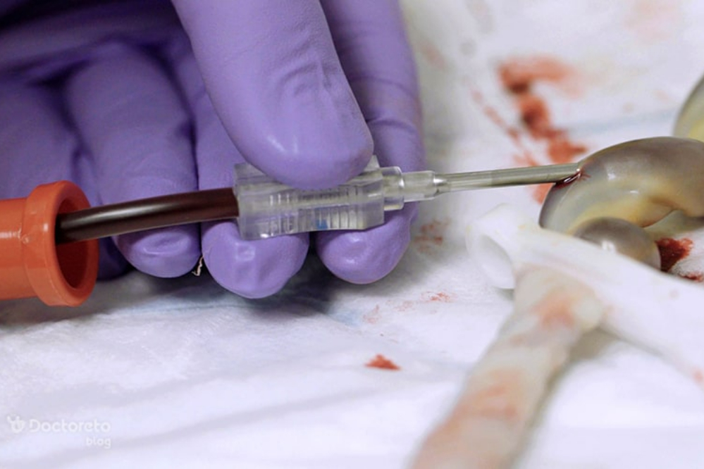 بزرگ‌ترین ظرفیت ذخیره‌سازی خون بندناف را در اختیار داریم