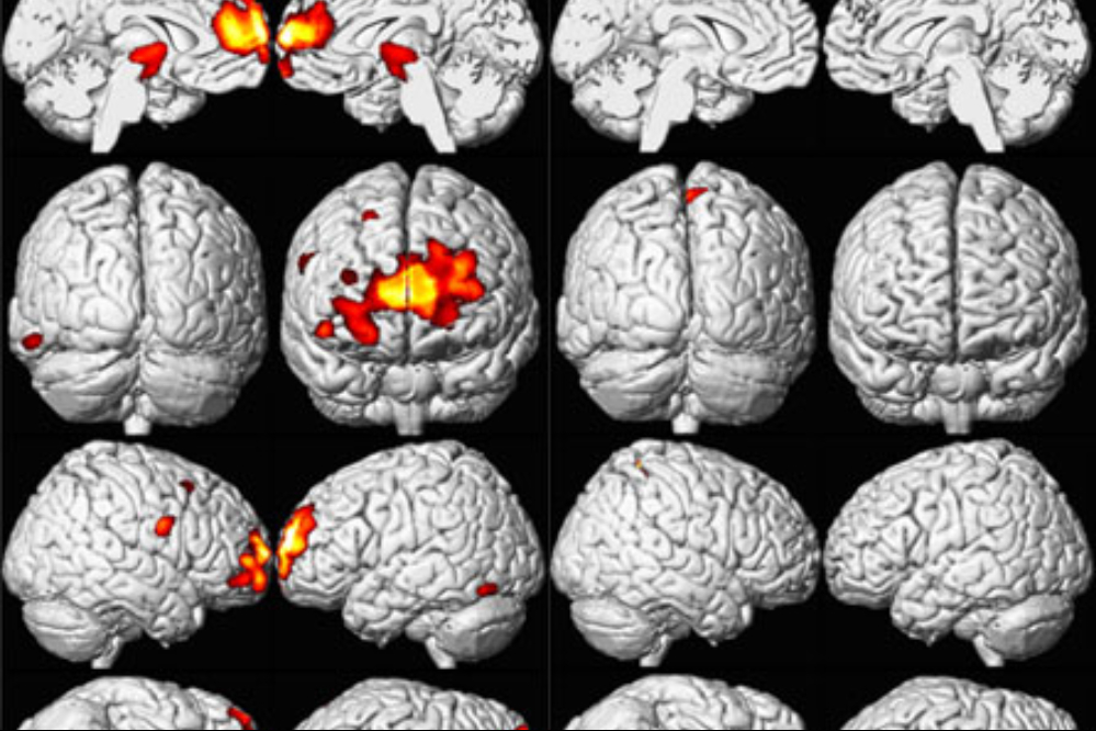 خطرات انباشت سرب در بدن بر سلامتی