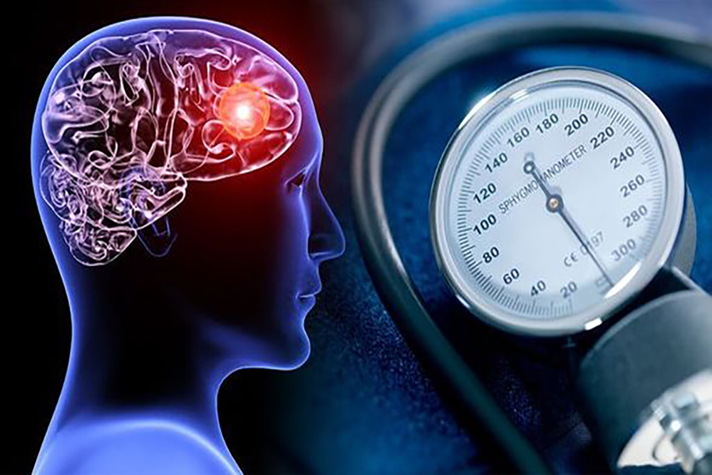 نوسان فشارخون برای مغز خطرناک است