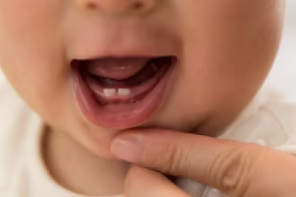 دندان‌ نوزادان مادران پراسترس زودتر درمی‌آید